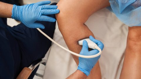 Doctor wearing gloves doing ultrasound on leg