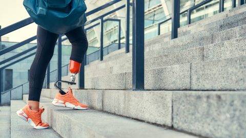 Woman in leg prosthesis in sports clothing