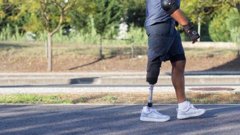 Man walking with prosthetic leg